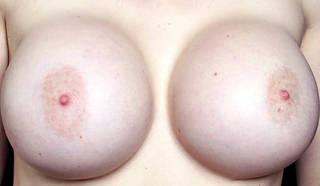 Colossal naked boobs.